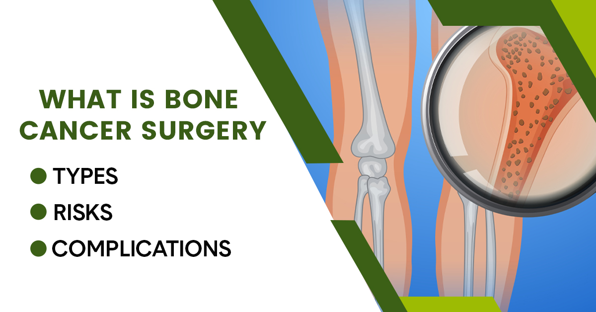 Bone Cancer Surgery