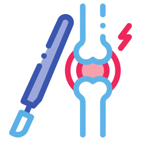 Arthroscopy