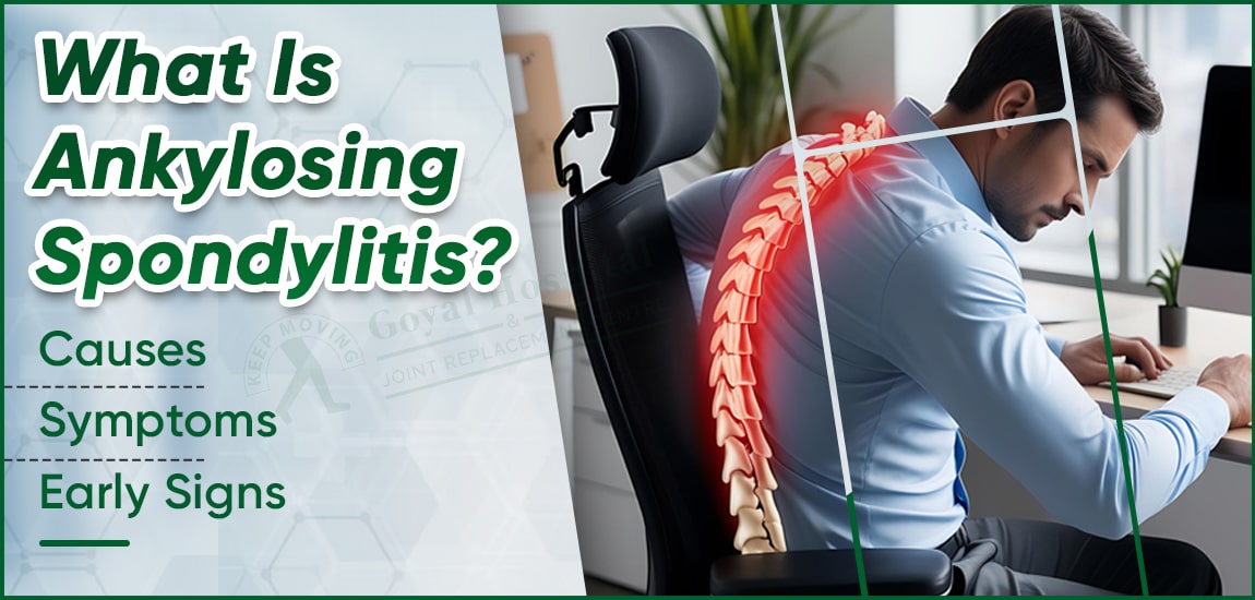 Ankylosing Spondylitis