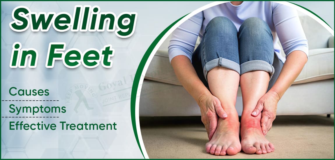 Swelling in Feet