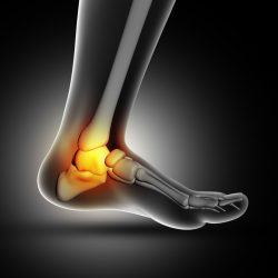 ankle arthroscopy
